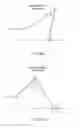 Fig. 29 - Electrosurgical device