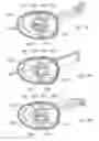 Fig. 34 - Electrosurgical device