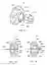Fig. 14 - Electrosurgical device
