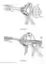Fig. 31 - Electrosurgical device