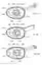Fig. 34 - Electrosurgical device