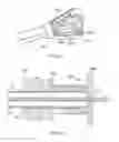Fig. 11 - Electrosurgical device