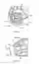 Fig. 19 - Electrosurgical device