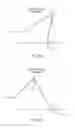 Fig. 29 - Electrosurgical device
