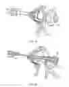 Fig. 31 - Electrosurgical device