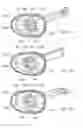 Fig. 34 - Electrosurgical device
