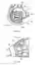 Fig. 19 - Electrosurgical device
