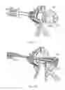 Fig. 31 - Electrosurgical device