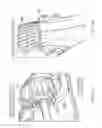 Fig. 32 - Electrosurgical device