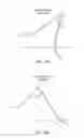 Fig. 29 - Electrosurgical device
