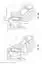 Fig. 33 - Electrosurgical device