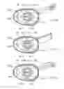 Fig. 34 - Electrosurgical device