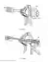 Fig. 31 - Electrosurgical device