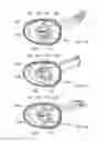 Fig. 34 - Electrosurgical device