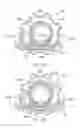 Fig. 16 - ELECTROSURGICAL DEVICE