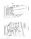 Fig. 32 - ELECTROSURGICAL DEVICE