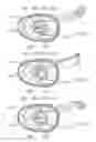 Fig. 34 - ELECTROSURGICAL DEVICE