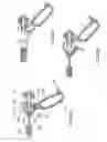 Fig. 24 - ELECTROSURGICAL DEVICE
