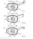 Fig. 34 - ELECTROSURGICAL DEVICE