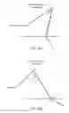 Fig. 29 - Electrosurgical device