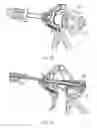 Fig. 31 - Electrosurgical device