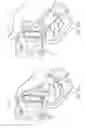 Fig. 33 - Electrosurgical device