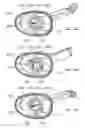 Fig. 34 - Electrosurgical device