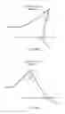 Fig. 29 - Electrosurgical device