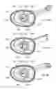 Fig. 34 - Electrosurgical device