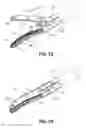 Fig. 03 - Surgical instrument