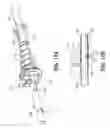 Fig. 11 - Surgical instrument