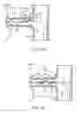 Fig. 04 - Method of manufacturing a shaping structure for denervation