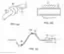 Fig. 06 - Method of manufacturing a shaping structure for denervation