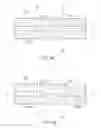 Fig. 07 - Method of manufacturing a shaping structure for denervation
