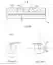 Fig. 08 - Method of manufacturing a shaping structure for denervation