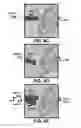 Fig. 05 - Image integration and robotic endoscope control in X-ray suite