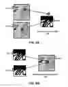 Fig. 08 - Image integration and robotic endoscope control in X-ray suite