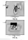 Fig. 09 - Image integration and robotic endoscope control in X-ray suite