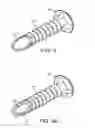 Fig. 03 - ILLUMINATED AND MODULAR SOFT TISSUE RETRACTOR