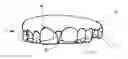 Fig. 01 - DENTAL DEVICE AND METHODS OF FORMING SAME