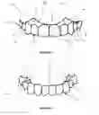 Fig. 06 - DENTAL DEVICE AND METHODS OF FORMING SAME