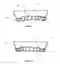 Fig. 07 - DENTAL DEVICE AND METHODS OF FORMING SAME