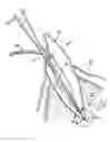 Fig. 01 - APPARATUS FOR EVACUATION OF ROOT CANAL