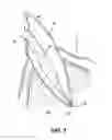 Fig. 02 - APPARATUS FOR EVACUATION OF ROOT CANAL