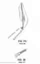 Fig. 03 - APPARATUS FOR EVACUATION OF ROOT CANAL