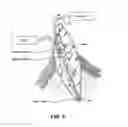 Fig. 06 - APPARATUS FOR EVACUATION OF ROOT CANAL