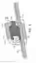 Fig. 05 - Apparatus for achieving molar distalization