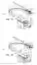Fig. 10 - Apparatus for achieving molar distalization