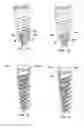 Fig. 04 - Dental implant