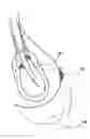 Fig. 01 - Nonaugmentive mastopexy